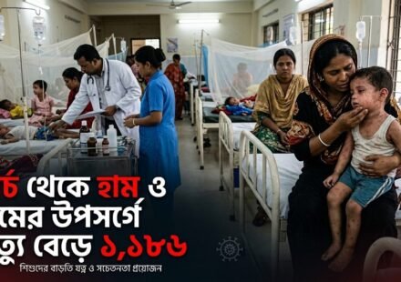 মার্চ থেকে হাম ও হামের উপসর্গে মৃত্যু বেড়ে ১ হাজার ১৮৬