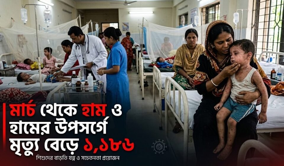মার্চ থেকে হাম ও হামের উপসর্গে মৃত্যু বেড়ে ১ হাজার ১৮৬
