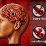 স্ট্রোকের লক্ষণ দেখলে দেরি নয়: সাড়ে ৪ ঘণ্টার মধ্যে চিকিৎসায় বাড়ে বাঁচার সম্ভাবনা